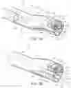 Fig. 09 - Endoscope and method of use