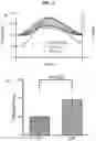 Fig. 07 - System and method to measure tissue biomechanical properties without external excitation