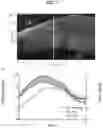 Fig. 08 - System and method to measure tissue biomechanical properties without external excitation