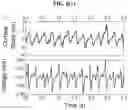 Fig. 10 - System and method to measure tissue biomechanical properties without external excitation
