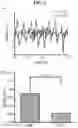 Fig. 11 - System and method to measure tissue biomechanical properties without external excitation