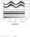 Fig. 03 - Systems and methods for measuring postlens tear film thickness
