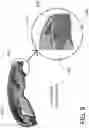 Fig. 14 - SYSTEMS AND METHODS FOR MEASURING PATIENT VITAL SIGNS