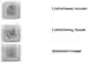 Fig. 20 - Graphical user interface for laser eye surgery system