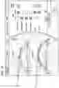 Fig. 76 - Graphical user interface for laser eye surgery system