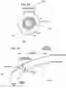 Fig. 86 - Graphical user interface for laser eye surgery system