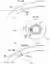 Fig. 89 - Graphical user interface for laser eye surgery system