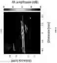 Fig. 09 - Method and system for fluence matching in photoacoustic imaging