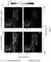 Fig. 10 - Method and system for fluence matching in photoacoustic imaging