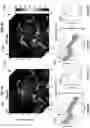 Fig. 12 - Method and system for fluence matching in photoacoustic imaging