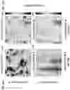 Fig. 14 - Method and system for fluence matching in photoacoustic imaging