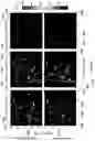 Fig. 16 - Method and system for fluence matching in photoacoustic imaging