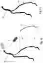 Fig. 08 - APPARATUS FOR VESSEL CHARACTERIZATION