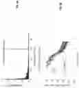 Fig. 07 - Artifact identification in EEG measurements