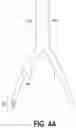 Fig. 05 - ENDOVASCULAR OCCLUSION DEVICE AND METHOD OF USE