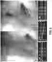Fig. 11 - ENDOVASCULAR OCCLUSION DEVICE AND METHOD OF USE