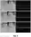Fig. 12 - ENDOVASCULAR OCCLUSION DEVICE AND METHOD OF USE
