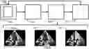 Fig. 01 - Ultrasound imaging system and method for deriving depth and identifying anatomical features associated with user identified point or region
