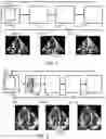 Fig. 02 - Ultrasound imaging system and method for deriving depth and identifying anatomical features associated with user identified point or region