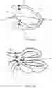 Fig. 09 - Method and system for closing left atrial appendage