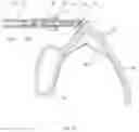 Fig. 04 - Laparoscopic clipping machine for application of surgical clips on tissue structures