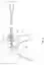 Fig. 22 - Laparoscopic clipping machine for application of surgical clips on tissue structures