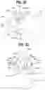 Fig. 15 - Radial saw blade and hub for osteotomy