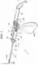 Fig. 02 - Bone and tissue resection devices and methods