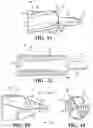 Fig. 09 - System and method for installing a bicortical implant in bone