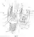 Fig. 02 - Spinal implant system and method