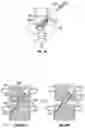 Fig. 07 - Distraction screw