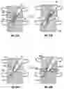 Fig. 08 - Distraction screw