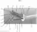 Fig. 03 - ELECTROSURGICAL PENCIL WITH A PROTECTIVE GUARD