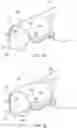 Fig. 02 - ADJUSTABLE IMMOBILIZER DEVICE AND METHOD FOR IMMOBILIZING A PATIENT