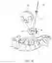 Fig. 07 - Device and method for automatic recalibration for 3D intraoperative images
