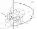 Fig. 01 - LINGUAL ORTHODONTIC APPLIANCE