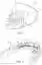 Fig. 03 - LINGUAL ORTHODONTIC APPLIANCE
