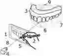 Fig. 01 - Computer implemented method for modifying a digital three-dimensional model of a dentition