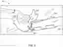 Fig. 03 - APPARATUS FOR SUCTION TUBE POSITIONING