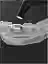 Fig. 01 - HEMOSTATIC PASTE WITH LIGHT-CURABLE FEATURE