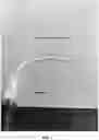 Fig. 02 - HEMOSTATIC PASTE WITH LIGHT-CURABLE FEATURE