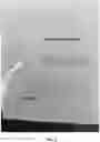 Fig. 03 - HEMOSTATIC PASTE WITH LIGHT-CURABLE FEATURE