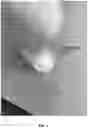 Fig. 05 - HEMOSTATIC PASTE WITH LIGHT-CURABLE FEATURE