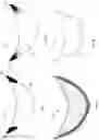 Fig. 05 - Surgical attachment device