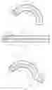 Fig. 02 - Covered stent