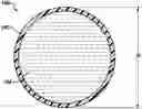 Fig. 01 - POST-LUMPECTOMY BREAST IMPLANT