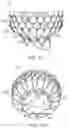 Fig. 09 - Prosthetic heart valve device and associated systems and methods