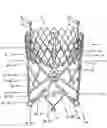 Fig. 01 - Stent for the positioning and anchoring of a valvular prosthesis in an implantation site in the heart of a patient