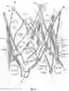 Fig. 20 - Stent for the positioning and anchoring of a valvular prosthesis in an implantation site in the heart of a patient