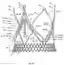 Fig. 28 - Stent for the positioning and anchoring of a valvular prosthesis in an implantation site in the heart of a patient